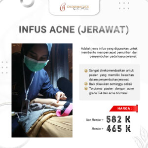 treatment-infus-acne-jerawat