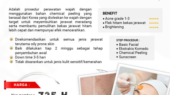 DERMAPEEL ACNE