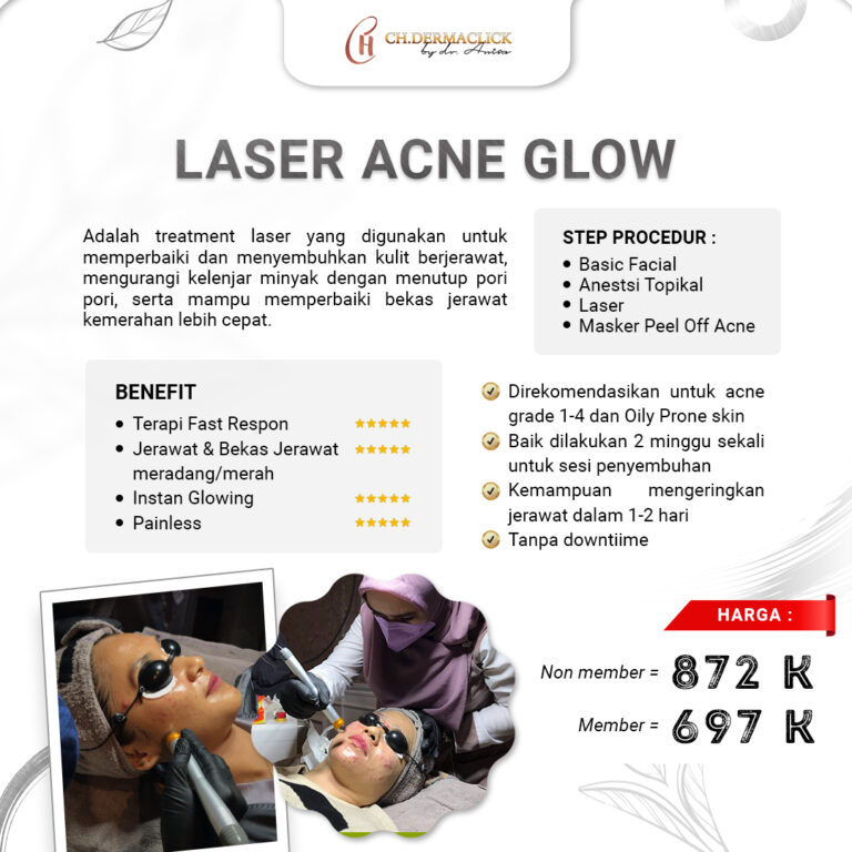 treatment-laser-acne-glow